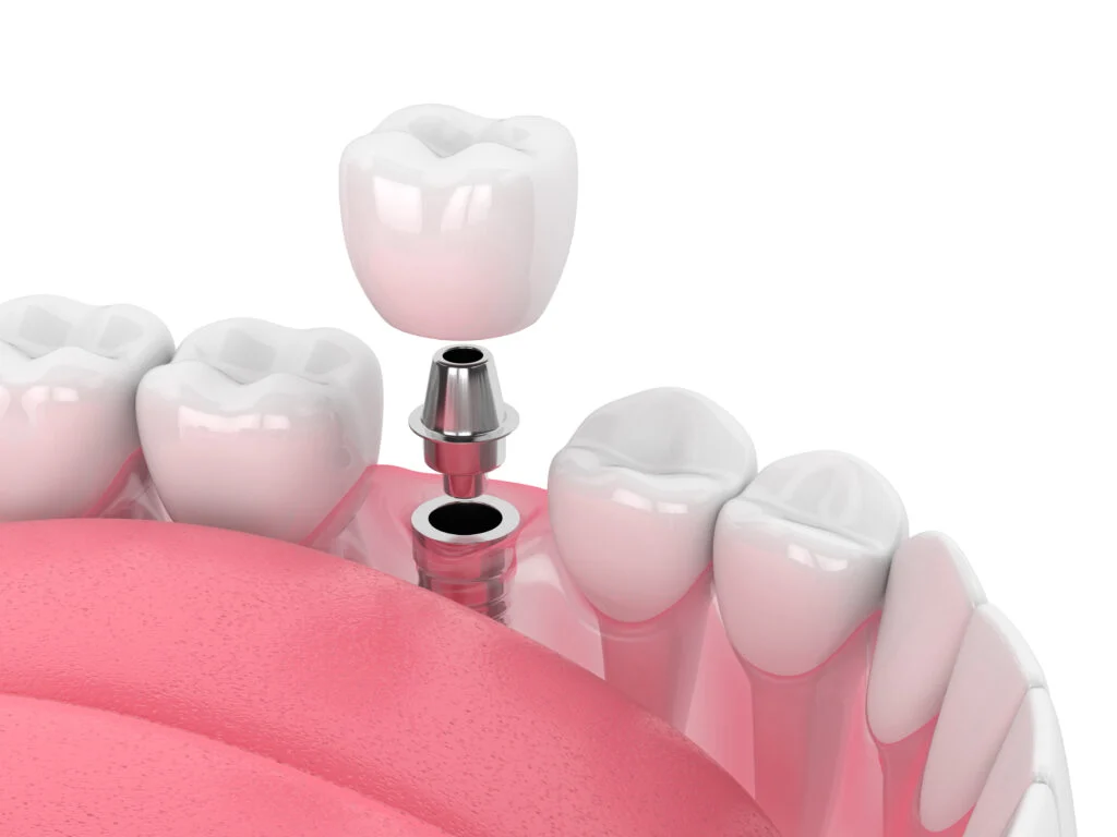 Ashburn Dental Care Ashburn Dental Care