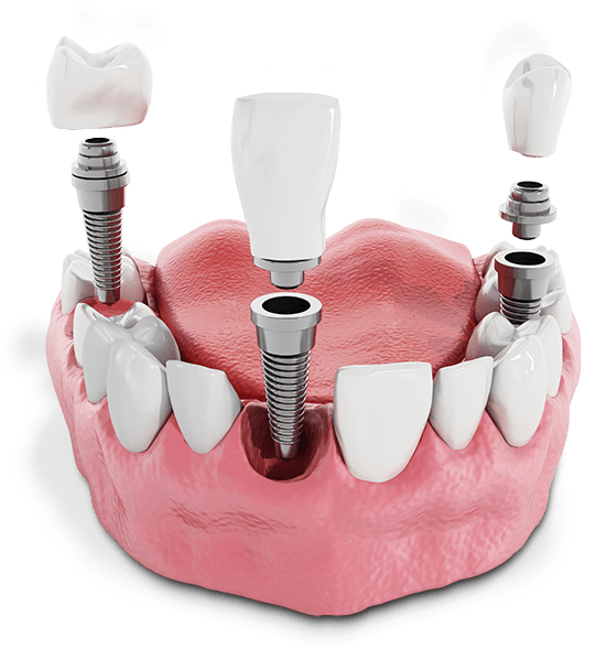 Ashburn Dental Care Ashburn Dental Care