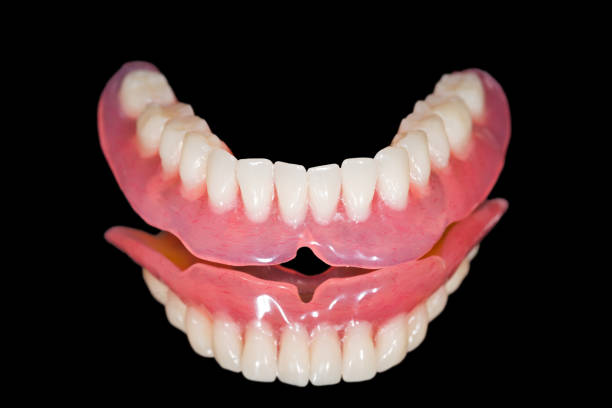 Dentist_Ashburn_VA_Full_Arch_Fixed_teeth Dentist_Ashburn_VA_Full_Arch_Fixed_teeth