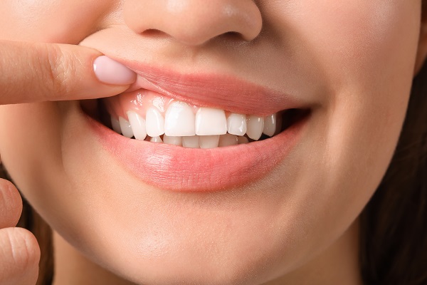 Dentist_Ashburn_VA_gum-health Dentist_Ashburn_VA_gum-health