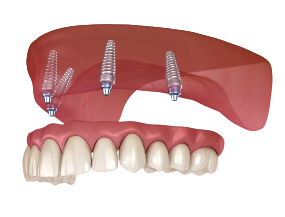 Ashburn Dental Care Ashburn Dental Care